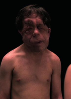 Adam Pearson Nude 54120
