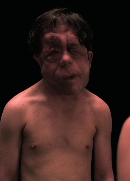 Adam Pearson Nude 54120