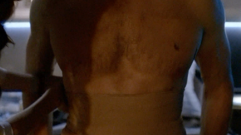 The Flash's Sexiest Scenes with Teddy Sears. Shirtless, bandage, big chest. 44142