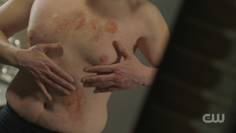 Sexiest Scenes of Tobias Whale from Black Lightning. Sexy, Shirtless, blood, burn marks. 81131