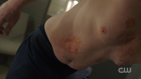 Hottest Tobias Whale Scenes. Sexy, Shirtless, blood, burn marks. 81129