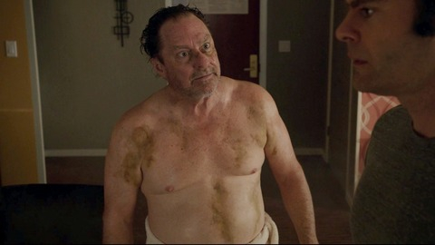 Stephen Root in Barry (2018-2022) Sexy Shirtless Bruised Dirty 81439