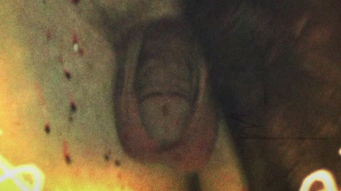 Blake French Naked as Burly Man. Balls, Penis, bloody, prosthetic. 131073