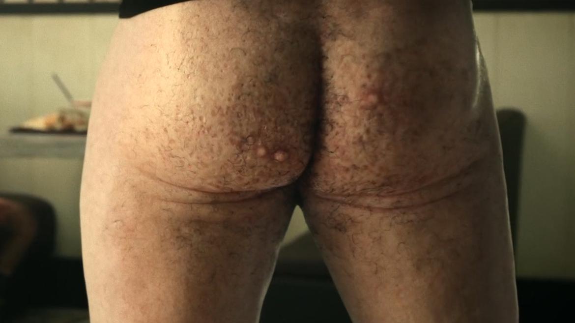 Simon Feek Nude as "Triggered?". Butt, Prosthetic. 82838