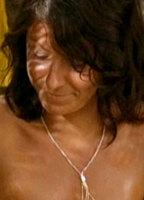 Berrit Arnold Bikini Breasts 241581