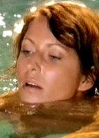 Berrit Arnold Bikini Breasts 241581