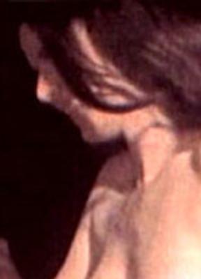 Helen Gross Breasts Bush 238245