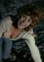 Anna Lynn Brown Breasts Right Breast 265938