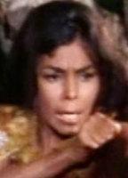 Yara Lex Breasts 241491