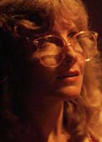 Margaret Howell Breasts Left Breast 81121