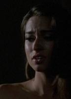 Niki Huey Model Breasts Right Breast 249063