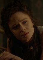 Maeve Dermody Breasts Left Breast 271935