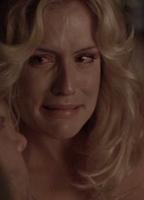 Kinsey Packard Bikini Breasts 251511