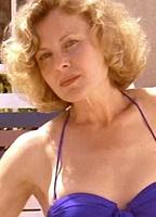 Rebecca Street Bikini 263970