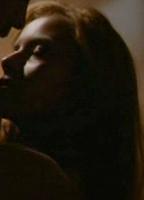 Irena A. Hoffman Breasts Right Breast 256134