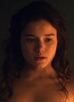 Hanna Mangan Lawrence Breasts Left Breast 228186