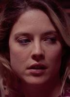 Zoe Grisedale Breasts Left Breast 273942