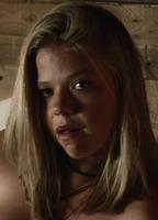 Vivien Endicott Douglas Breasts Right Breast 231087