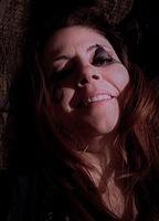 Susan Engel Breasts Right Breast 269403