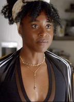 Kirby Howell-Baptiste Bikini Lesbian 271809