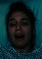 Mariela Garriga Bush Prosthetic 272397