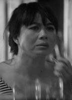 Yea-Ming Chen Breasts Right Breast 276642