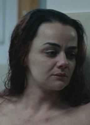 Hayley Squires Prosthetic Sexy 279500