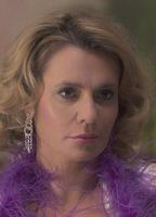 Anna Oberc Breasts Right Breast 281186