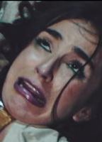 Beatriz Severo Breasts Prosthetic 281579