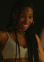 Ana Bokesa Breasts Right Breast 286321