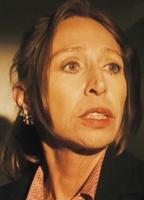 Keely Dervin Breasts 290452