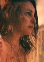 Laura Hunter Breasts Prosthetic 292509