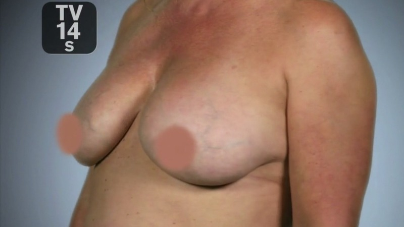 Hottest Nicole Eggert Scene in Botched. Sexy, big breasts, breast close-up. 762458