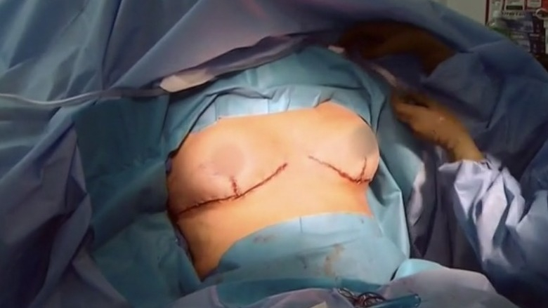 Hottest Nicole Eggert Scene in Botched. Sexy, big breasts, censored. 762464