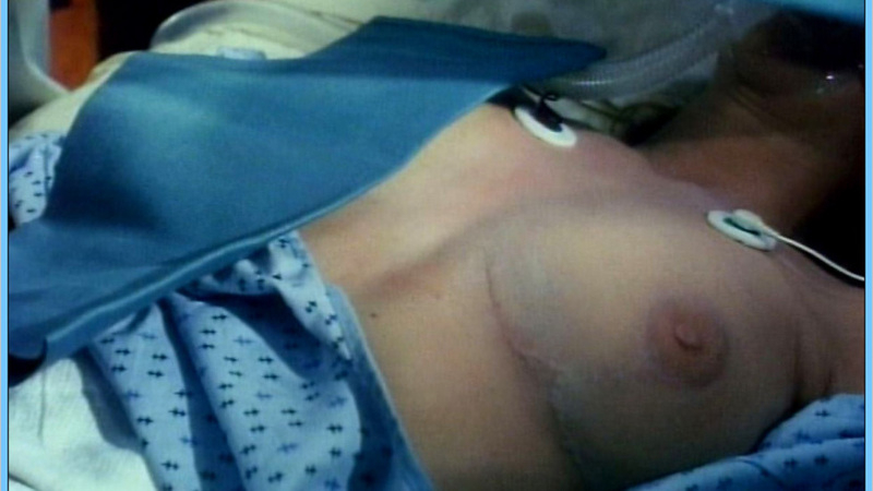 Kathleen Kinmont Naked as Gloria the Bride. Breasts, hospital, in bed. 545709
