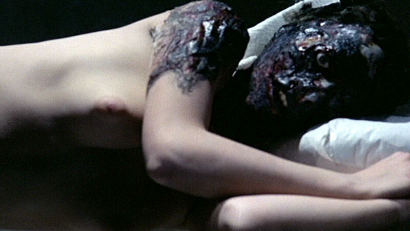 Linda from The Pyjama Girl Case Naked. Breasts, Body Double, burnt face, lying on side. 565205