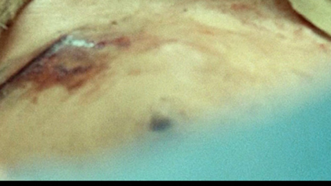 Naomi Watts in The Impossible (2012) Breasts Black Eye Bloody 725081