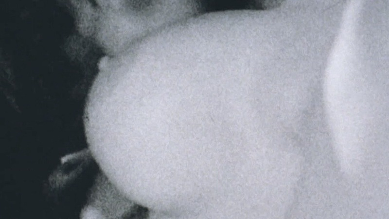 Julie Strain Nude as Herself (Facelift Death). Breasts, black and white, breast close-up. 774230