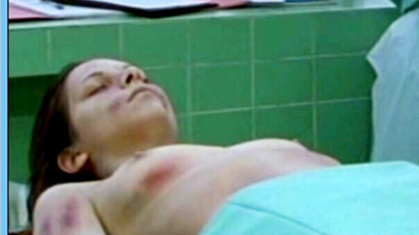 Silvana Bayer Naked in Der letzte Zeuge. Breasts, bruised, brunette. 656251