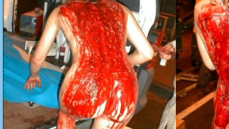 Nudes of Lynn Wilson from Tattoo. Butt, bloody, bloody back. 602574