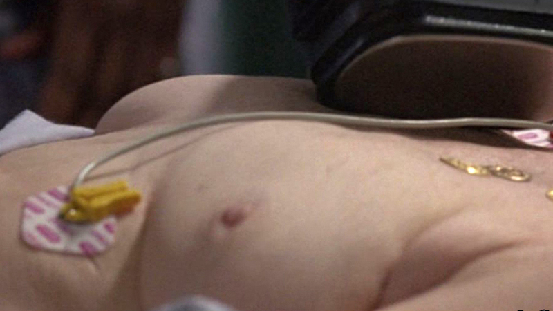 Rosemary Murphy Nude as Angela. Breasts, hospital bed, mature. 562808