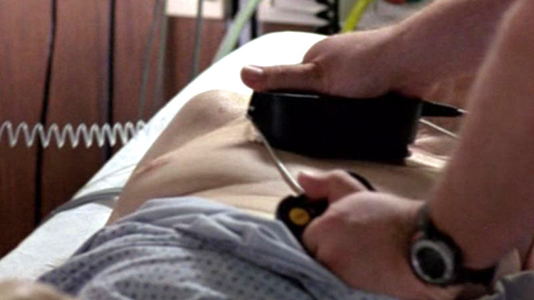 Rosemary Murphy Naked as Angela. Breasts, hospital bed, nude. 562809