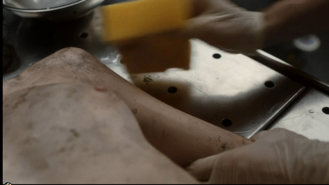 Anna Brewster in Silent Witness (1996-2018) Breasts Autopsy Breasts 720050
