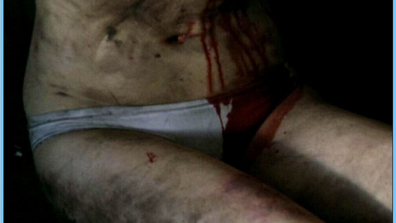 Hottest Kimberly Scenes. Underwear, SFW, bloody. 640785