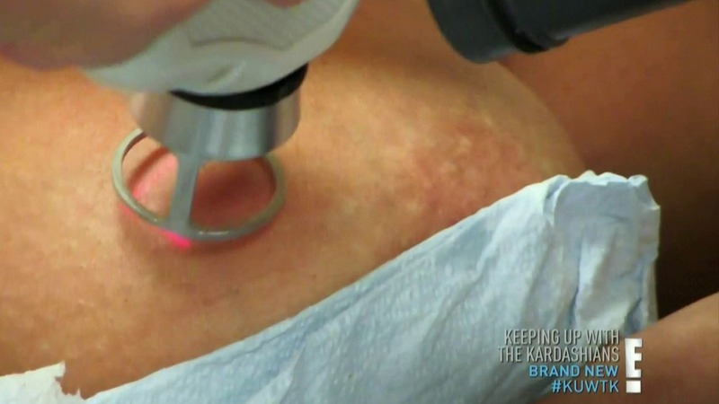 Keeping Up with the Kardashians's Sexiest Scenes with Kim Kardashian. Sexy, medical equipment. 735390
