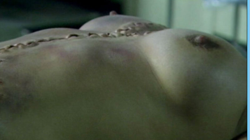 Lauren Hood Naked as Sharon Williams. Breasts, exam table, hard nipples. 651519