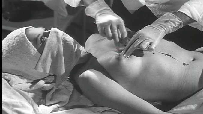 Mara Laso Naked as Irma Gold. Breasts, awake during surgery, black and white. 707703