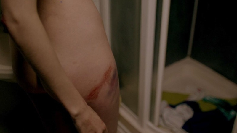 Agyness Deyn Nude as Lily O'Connor. Butt, blood, bruise. 761828