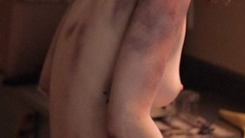 Girl from Thanatomorphose Naked. Breasts, bruises, injured. 739733