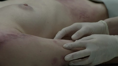 Daisy Ridley in Silent Witness (1996-2018) Breasts Autopsy Breasts 739594